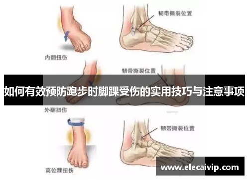 如何有效预防跑步时脚踝受伤的实用技巧与注意事项